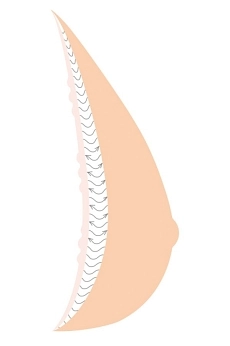 3-layer-bf-adapt-illu-ai-orez (1).jpg